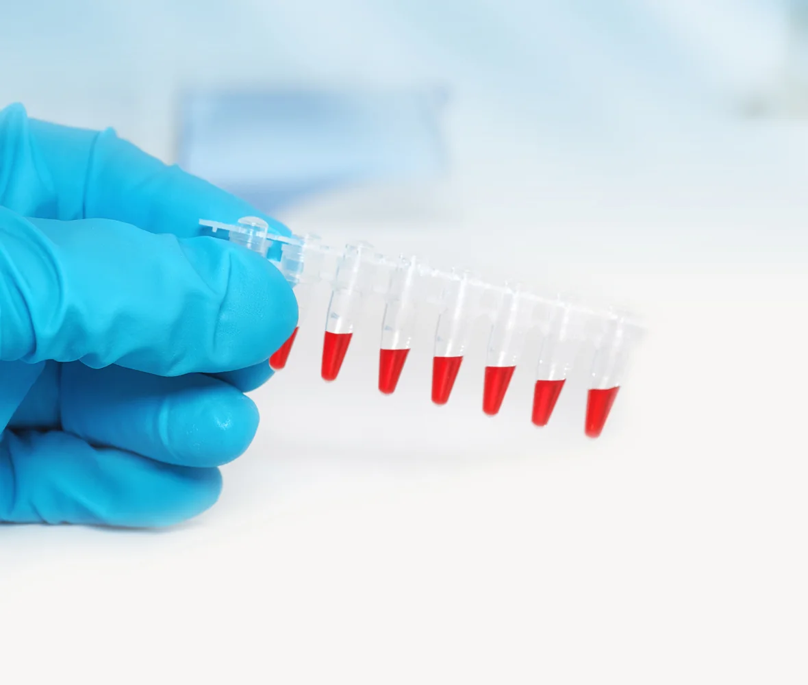 Biomarker Discovery